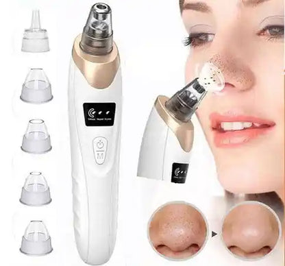 DermaSoin™ – Adieu aux points noirs, bonjour à une peau éclatante