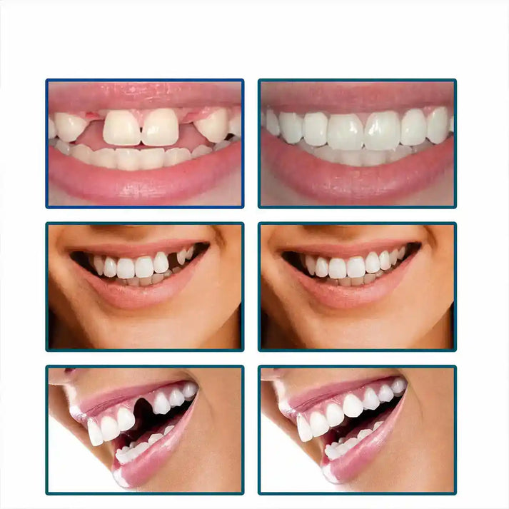 Kit de Dents Ajustables – Sourire Confiant Instantané 🇨🇩